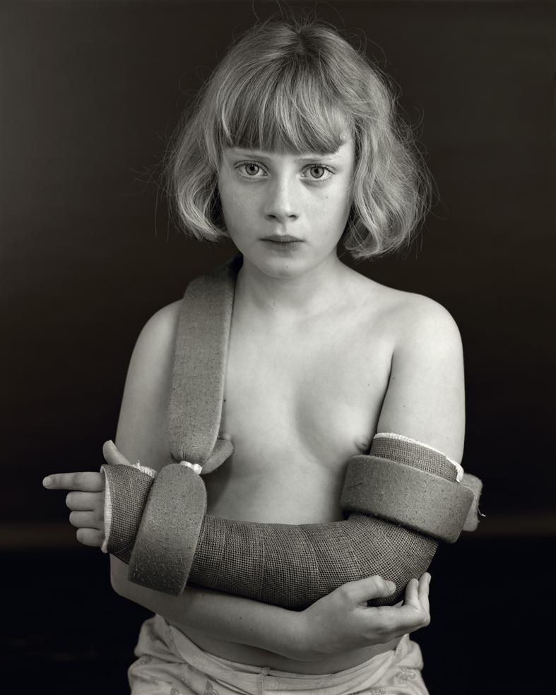 Black and white portrait of a young child with blonde bob-cut hair and bangs, shown from the shoulders up against a dark background. The child wears wrapped bandages or cloth strips around both arms and torso in a sculptural arrangement, creating an austere, formal composition with classical portraiture lighting.